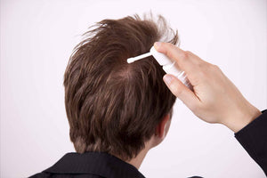 Mastering Minoxidil: Essential Dos and Don