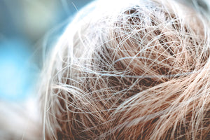 Low Alcohol Minoxidil for Effective Hair Regrowth