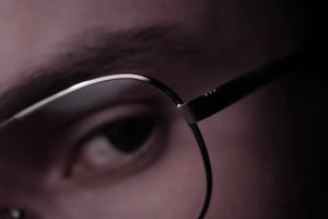 Understanding Stress-Related Hair Loss