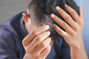 Men's Minoxidil Treatments with Optimal Supply Options