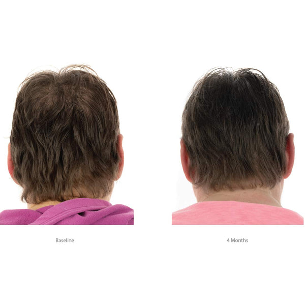 FOLIGAIN Triple Action Hair Care System For Women 3 Piece Trial Set - FOLIGAIN